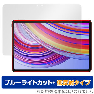 Xiaomi Redmi Pad Pro ی tB OverLay Eye Protector ᔽ for VI~[ h~ pbh v u[CgJbg ˖h~