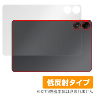 Xiaomi Redmi Pad Pro w ی tB OverLay Plus for VI~[ h~ pbh v {̕یtB 炳G ᔽˑf