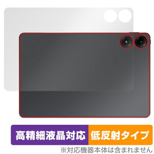 Xiaomi Redmi Pad Pro w ی tB OverLay Plus Lite for VI~[ h~ pbh v {̕ی 炳G ᔽˑf
