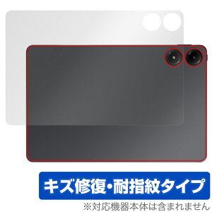 Xiaomi Redmi Pad Pro w ی tB OverLay Magic for VI~[ h~ pbh v {̕ی C wh~ R[eBO