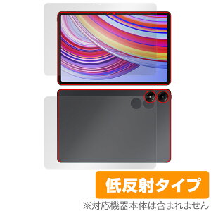 Xiaomi Redmi Pad Pro \ w tB OverLay Plus for VI~[ h~ pbh v \ʁEw A`OA ˖h~ 