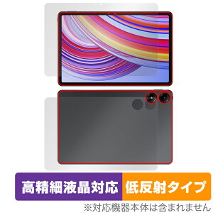 Xiaomi Redmi Pad Pro \ w tB OverLay Plus Lite for VI~[ h~ pbh v \ʁEw ׉tΉA`OA