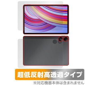 Xiaomi Redmi Pad Pro \ w tB OverLay Plus Premium for VI~[ h~ pbh v \ʁEw A`OA 