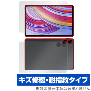 Xiaomi Redmi Pad Pro \ w tB OverLay Magic for VI~[ h~ pbh v \ʁEwʃZbg C ώw wh~