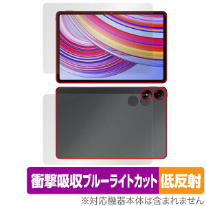 Xiaomi Redmi Pad Pro \ w tB OverLay Absorber ᔽ for VI~[ h~ pbh v Ռzu[CgJbg R