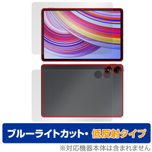 Xiaomi Redmi Pad Pro \ w tB OverLay Eye Protector ᔽ for VI~[ h~ pbh v u[CgJbg˖h~