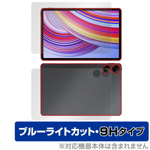 Xiaomi Redmi Pad Pro \ w tB OverLay Eye Protector 9H for VI~[ h~ pbh v 9H dx u[CgJbg