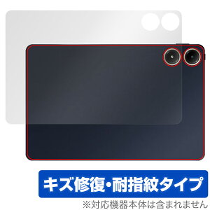 Xiaomi POCO Pad w ی tB OverLay Magic for VI~[ |R pbh {̕یtB C wh~ R[eBO
