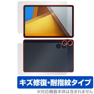 Xiaomi POCO Pad \ w tB OverLay Magic for VI~[ |R pbh \ʁEwʃZbg C ώw wh~ R[eBO