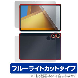 Xiaomi POCO Pad \ w tB OverLay Eye Protector for VI~[ |R pbh \ʁEwʃZbg ڂɗDu[CgJbg