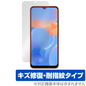 Blackview A52 Pro / A52 �ی� �t�B���� OverLay Magic for �u���b�N�r���[ �X�}�[�g�t�H�� ���C�� �ώw�� �w��h�~ �R�[�e�B���O