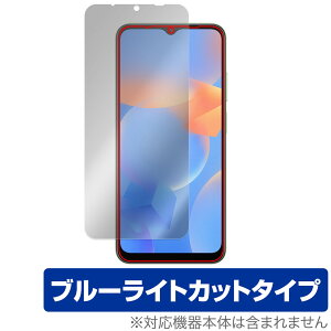 Blackview A52 Pro / A52 �ی� �t�B���� OverLay Eye Protector for �u���b�N�r���[ �X�}�[�g�t�H�� �ڂɗD���� �u���[���C�g�J�b�g