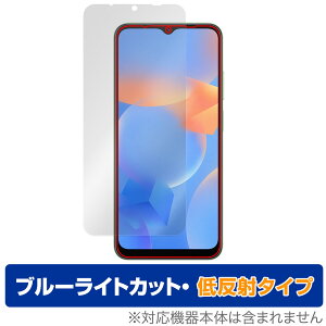 Blackview A52 Pro / A52 �ی� �t�B���� OverLay Eye Protector �ᔽ�� for �u���b�N�r���[ �X�}�[�g�t�H�� �u���[���C�g�J�b�g ���˖h�~