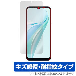 Blackview WAVE 6C �ی� �t�B���� OverLay Magic for �u���b�N�r���[ �X�}�[�g�t�H�� �t���ی� ���C�� �ώw�� �w��h�~ �R�[�e�B���O