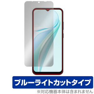 Blackview WAVE 6C �ی� �t�B���� OverLay Eye Protector for �u���b�N�r���[ �X�}�[�g�t�H�� �t���ی� �ڂɗD���� �u���[���C�g�J�b�g