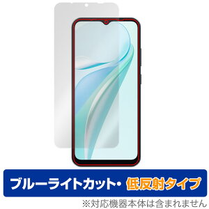 Blackview WAVE 6C �ی� �t�B���� OverLay Eye Protector �ᔽ�� for �u���b�N�r���[ �X�}�[�g�t�H�� �u���[���C�g�J�b�g ���˖h�~