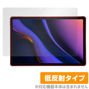 AGM PAD P2 �ی� �t�B���� OverLay Plus for AGM �^�u���b�g �t���ی� �A���`�O���A ���˖h�~ ����� �w��h�~