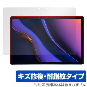 AGM PAD P2 ی tB OverLay Magic for AGM ^ubg tی C ώw wh~ R[eBO