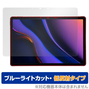 AGM PAD P2 �ی� �t�B���� OverLay Eye Protector �ᔽ�� for AGM �^�u���b�g �t���ی� �u���[���C�g�J�b�g ���˖h�~