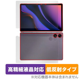 AGM PAD P2 \ w tB OverLay Plus Lite for AGM ^ubg \ʁEwʃZbg ׉tΉ A`OA ˖h~ 