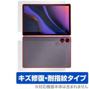 AGM PAD P2 �\�� �w�� �t�B���� OverLay Magic for AGM �^�u���b�g �\�ʁE�w�ʃZ�b�g ���C�� �ώw�� �w��h�~ �R�[�e�B���O