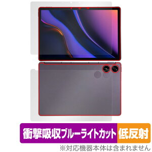 AGM PAD P2 \ w tB OverLay Absorber ᔽ for AGM ^ubg \ʁEw Ռz ˖h~ u[CgJbg R