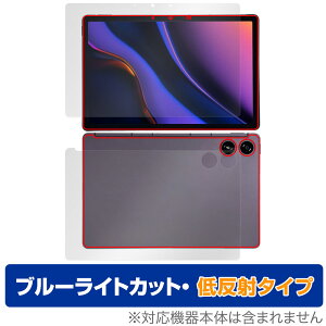 AGM PAD P2 \ w tB OverLay Eye Protector ᔽ for AGM ^ubg \ʁEwʃZbg u[CgJbg ˖h~