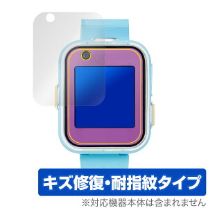 ݂RX}[gEHb`{ ی tB OverLay Magic for ݂R炵 tی C ώw wh~ R[eBO