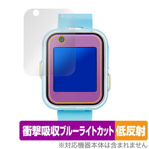 ݂RX}[gEHb`{ ی tB OverLay Absorber ᔽ for ݂R炵 Ռz ˖h~ u[CgJbg R