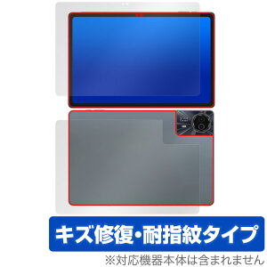 ODEA S11 \ w tB OverLay Magic for ODEA ^ubg S11 \ʁEwʃZbg C ώw wh~ R[eBO