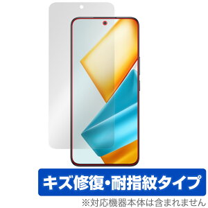 Honor 90 GT �ی� �t�B���� OverLay Magic for �I�i�[ �X�}�[�g�t�H�� �t���ی� ���C�� �ώw�� �w��h�~ �R�[�e�B���O