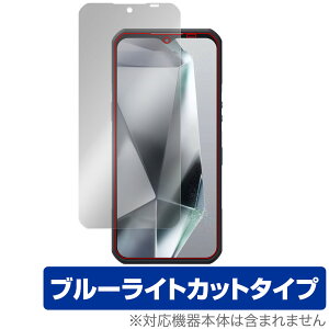 OUKITEL WP35 �ی� �t�B���� OverLay Eye Protector for �I�E�L�e�� �X�}�z �t���ی� �ڂɗD���� �u���[���C�g�J�b�g