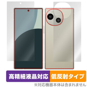 AQUOS R9 SH-51E A401SH \ w tB OverLay Plus Lite for ANIXA[ \ʁEwʃZbg ׉tΉ A`OA