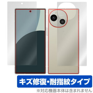 AQUOS R9 SH-51E A401SH \ w tB OverLay Magic for ANIXA[ \ʁEwʃZbg C ώw wh~ R[eBO