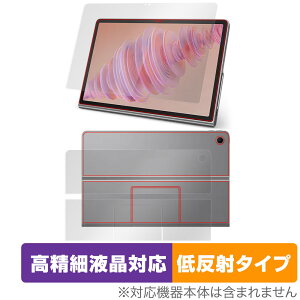 Lenovo Tab Plus �\�� �w�� �t�B���� OverLay Plus Lite for ���m�{ �^�u �v���X �\�ʁE�w�ʃZ�b�g �����׉t���Ή� �A���`�O���A ���˖h�~
