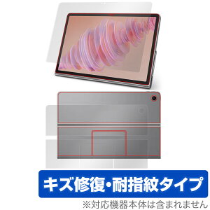 Lenovo Tab Plus \ w tB OverLay Magic for m{ ^u vX \ʁEwʃZbg C ώw wh~ R[eBO