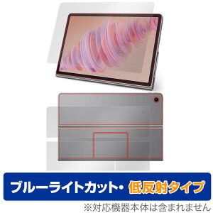 Lenovo Tab Plus \ w tB OverLay Eye Protector ᔽ for m{ ^u vX \ʁEw u[CgJbg ˖h~
