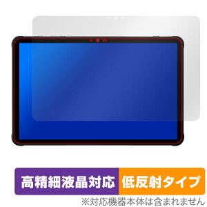 UMIDIGI Active T1 �ی� �t�B���� OverLay Plus Lite for ���~�f�B�W �A�N�e�B�u �����׉t���Ή� �A���`�O���A ���˖h�~ ����� �w��h�~