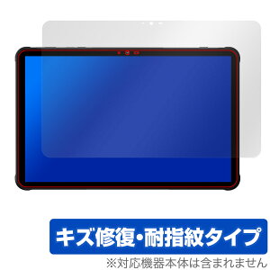 UMIDIGI Active T1 �ی� �t�B���� OverLay Magic for ���~�f�B�W �A�N�e�B�u �t���ی� ���C�� �ώw�� �w��h�~ �R�[�e�B���O