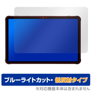 UMIDIGI Active T1 �ی� �t�B���� OverLay Eye Protector �ᔽ�� for ���~�f�B�W �A�N�e�B�u �t���ی� �u���[���C�g�J�b�g ���˖h�~