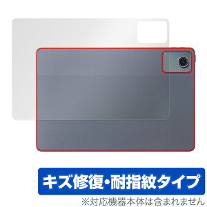 NEC LAVIE Tab T11 T1155/HAS 11^Ch w ی tB OverLay Magic for B ^ubg {̕یtB C wh~
