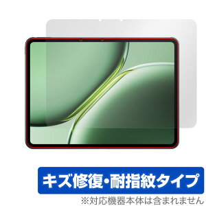 OnePlus Pad Pro ی tB OverLay Magic for vX ^ubg tی C ώw wh~ R[eBO