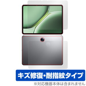 OnePlus Pad Pro �\�� �w�� �t�B���� OverLay Magic for �����v���X �^�u���b�g �\�ʁE�w�ʃZ�b�g ���C�� �ώw�� �w��h�~ �R�[�e�B���O