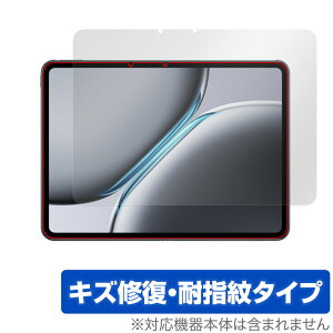 OnePlus Pad 2 �ی� �t�B���� OverLay Magic for �����v���X �^�u���b�g �t���ی� ���C�� �ώw�� �w��h�~ �R�[�e�B���O