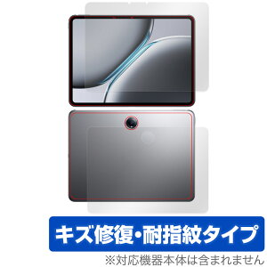 OnePlus Pad 2 �\�� �w�� �t�B���� OverLay Magic for �����v���X �^�u���b�g �\�ʁE�w�ʃZ�b�g ���C�� �ώw�� �w��h�~ �R�[�e�B���O