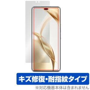 Honor 200 Pro �ی� �t�B���� OverLay Magic for �I�i�[ �X�}�[�g�t�H�� �t���ی� ���C�� �ώw�� �w��h�~ �R�[�e�B���O