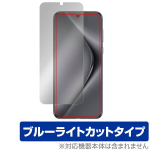 HUAWEI Pura 70 Ultra ی tB OverLay Eye Protector for t@[EFC X}[gtH tی ڂɗD u[CgJbg