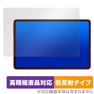 ALLDOCUBE iPlay 60 Pad Pro ی tB OverLay Plus Lite for I[hL[u ׉tΉ A`OA ˖h~ 