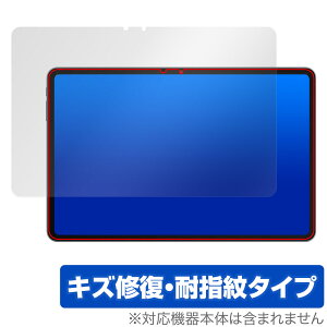 ALLDOCUBE iPlay 60 Pad Pro ی tB OverLay Magic for I[hL[u tی C ώw wh~ R[eBO