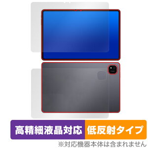 ALLDOCUBE iPlay 60 Pad Pro \ w tB OverLay Plus Lite for I[hL[u ׉tΉ A`OA ˖h~ 